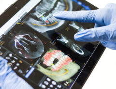Eine Hand in Handschuhen, die auf ein Tablet zeigt, ist zu sehen. Auf dem Tablet sind Röntgenaufnahmen von Zähnen abgebildet.
