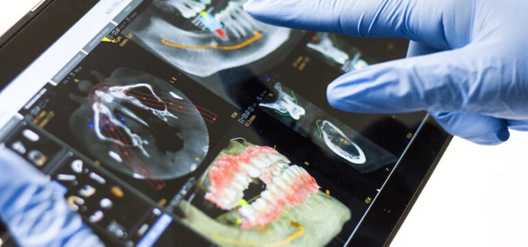 Eine Hand in Handschuhen, die auf ein Tablet zeigt, ist zu sehen. Auf dem Tablet sind Röntgenaufnahmen von Zähnen abgebildet.