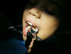 Eine Frau während einer zahnärztlichen Behandlung.