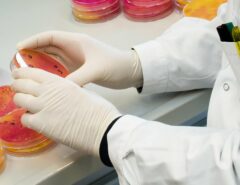 Eine Person mit Laborproben.